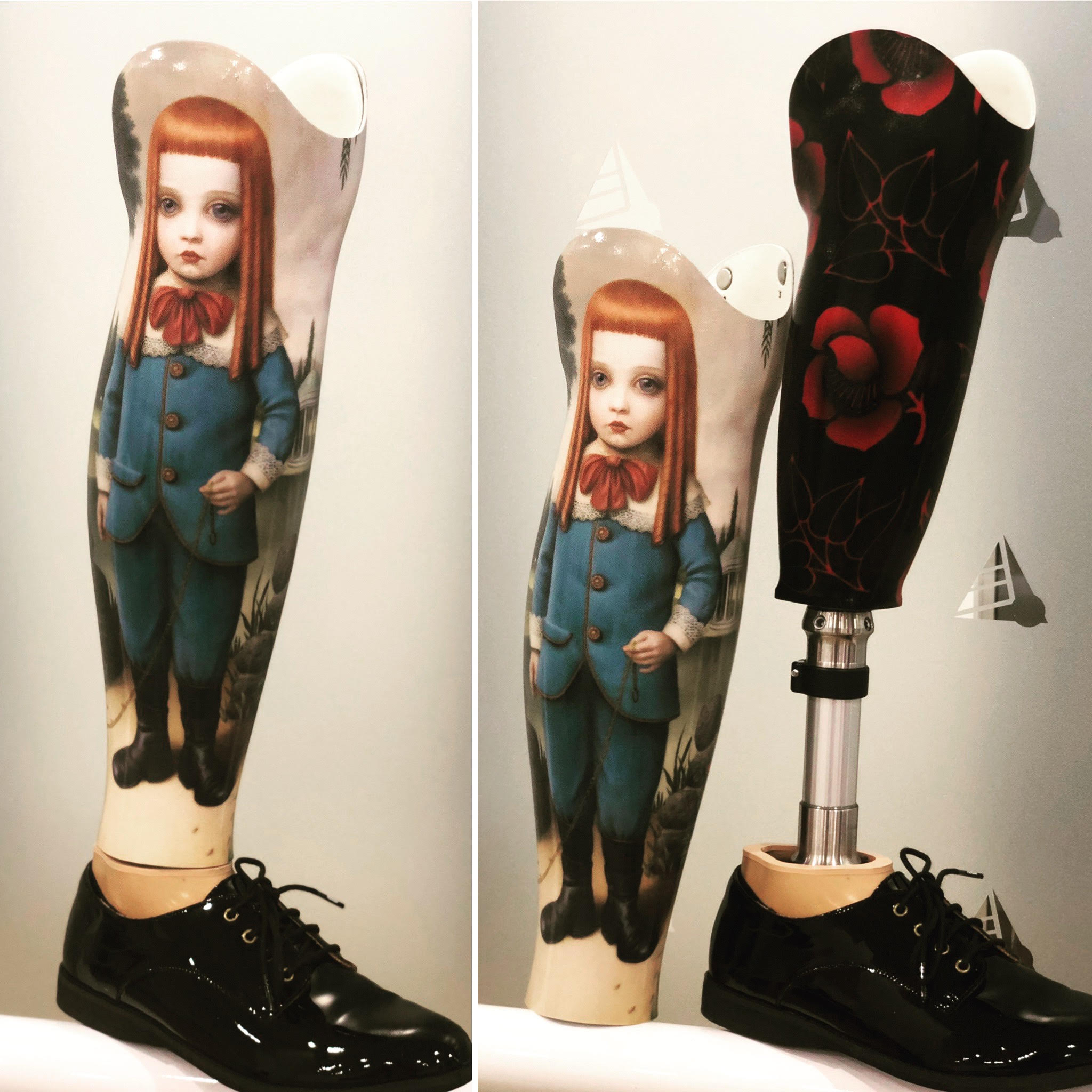 Priscilla Sutton’s prosthetic leg with cover artwork by Marion Peck, "Young Lord Oliver", 2007.